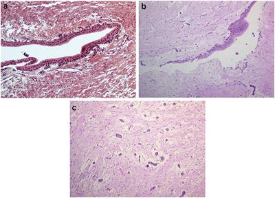 Age-Related Metabolic Pathways Changes in Dental Follicles: A Pilot Study